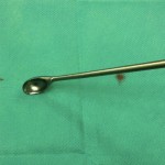 curette